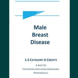 Male Breast Disease
